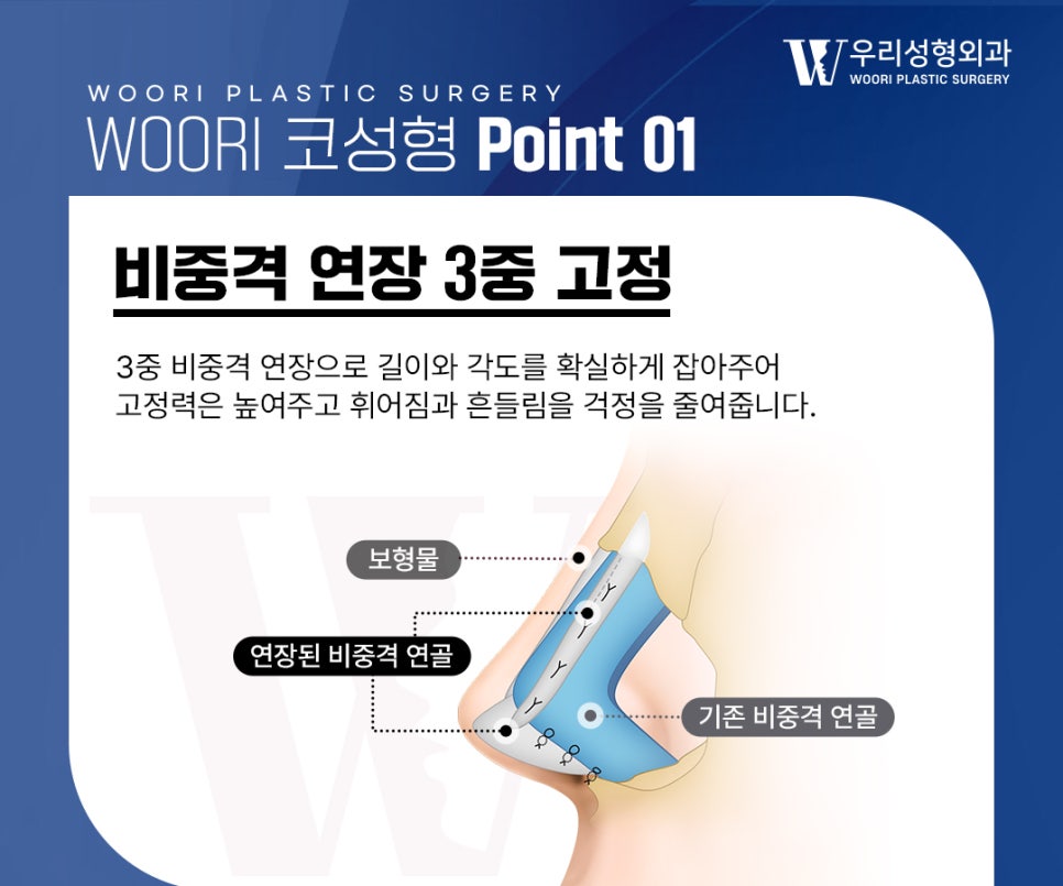 Why Functional Rhinoplasty Should Consider Both Nasal Function and Design image 2