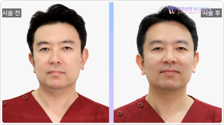 올리지오 주기 어떻게 되나요? 관련 이미지 6