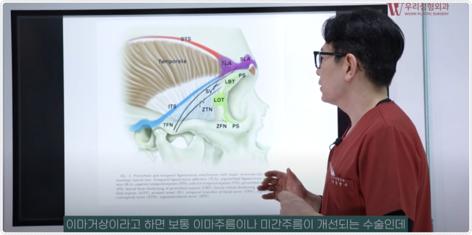 내시경이마거상술 비용 알아보기 전 관련 이미지 2
