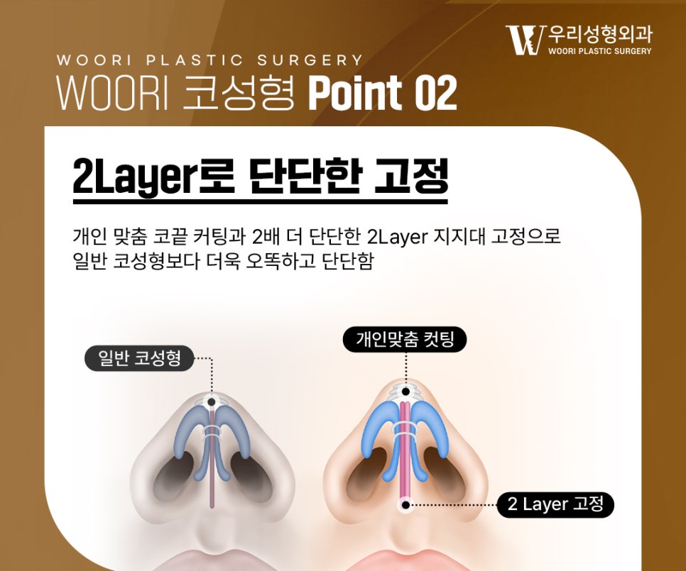 코성형 만족도를 높이는 디자인 포인트 관련 이미지 4