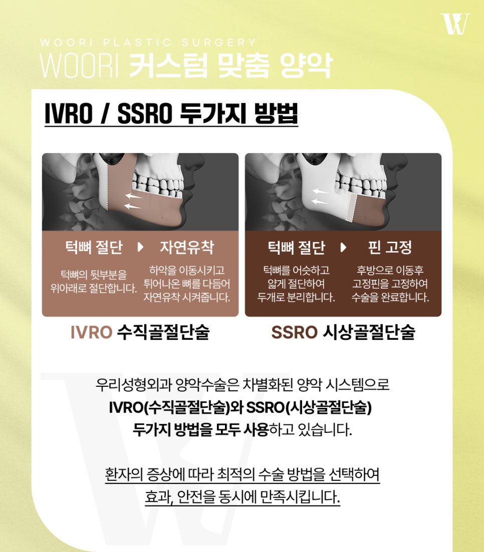 얼굴비대칭 양악수술로 개선 가능한 경우는? 관련 이미지 3