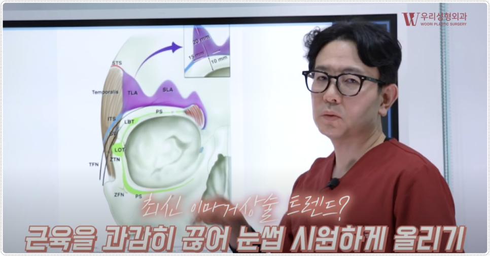 내시경이마거상술 비용 알아보기 전 관련 이미지 6