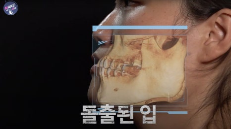 우리성형외과 X 맥미걸 메이크오버 프로젝트 첫 방영 관련 이미지 9