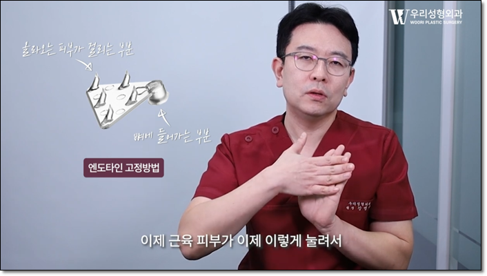 이마거상 후기 잘 된 케이스는? 관련 이미지 2
