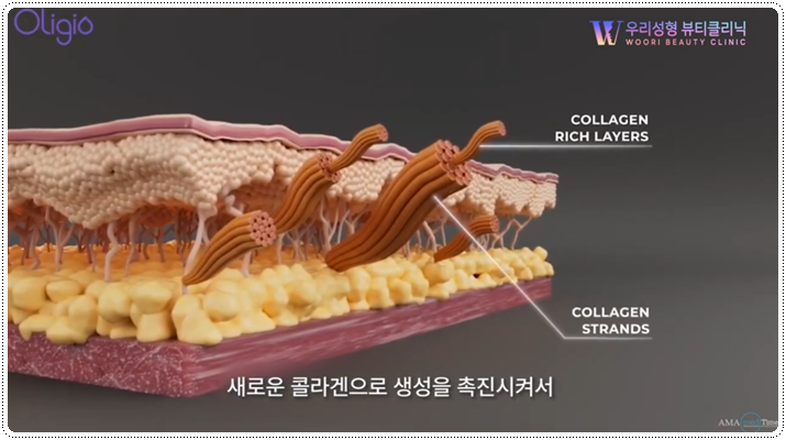 올리지오 주기 어떻게 되나요? 관련 이미지 2