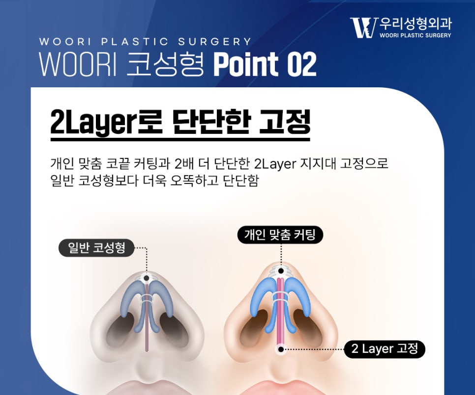Why Functional Rhinoplasty Should Consider Both Nasal Function and Design image 3