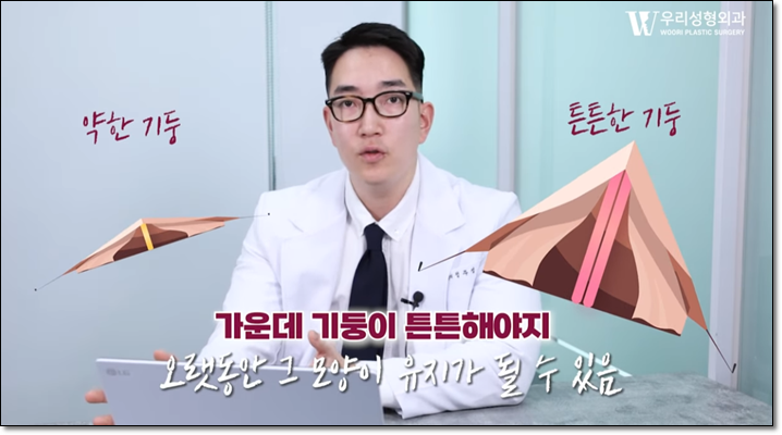 코성형외과 차이 비교해보기 관련 이미지 5