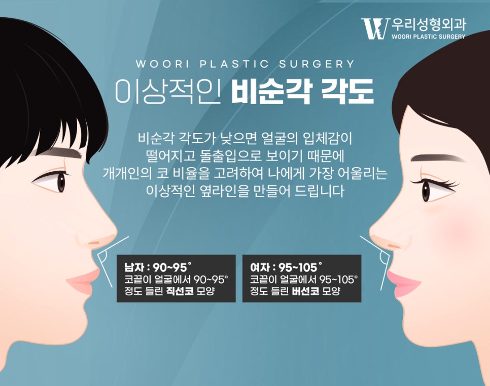 복코 개선 인상이 달라보이는 이유 관련 이미지 5