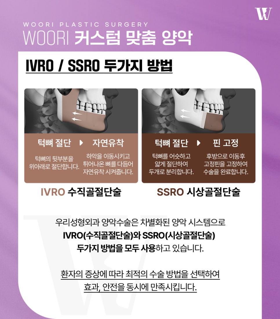 주걱턱수술 전 체크해야 할 얼굴 유형과 변화 방향 관련 이미지 4