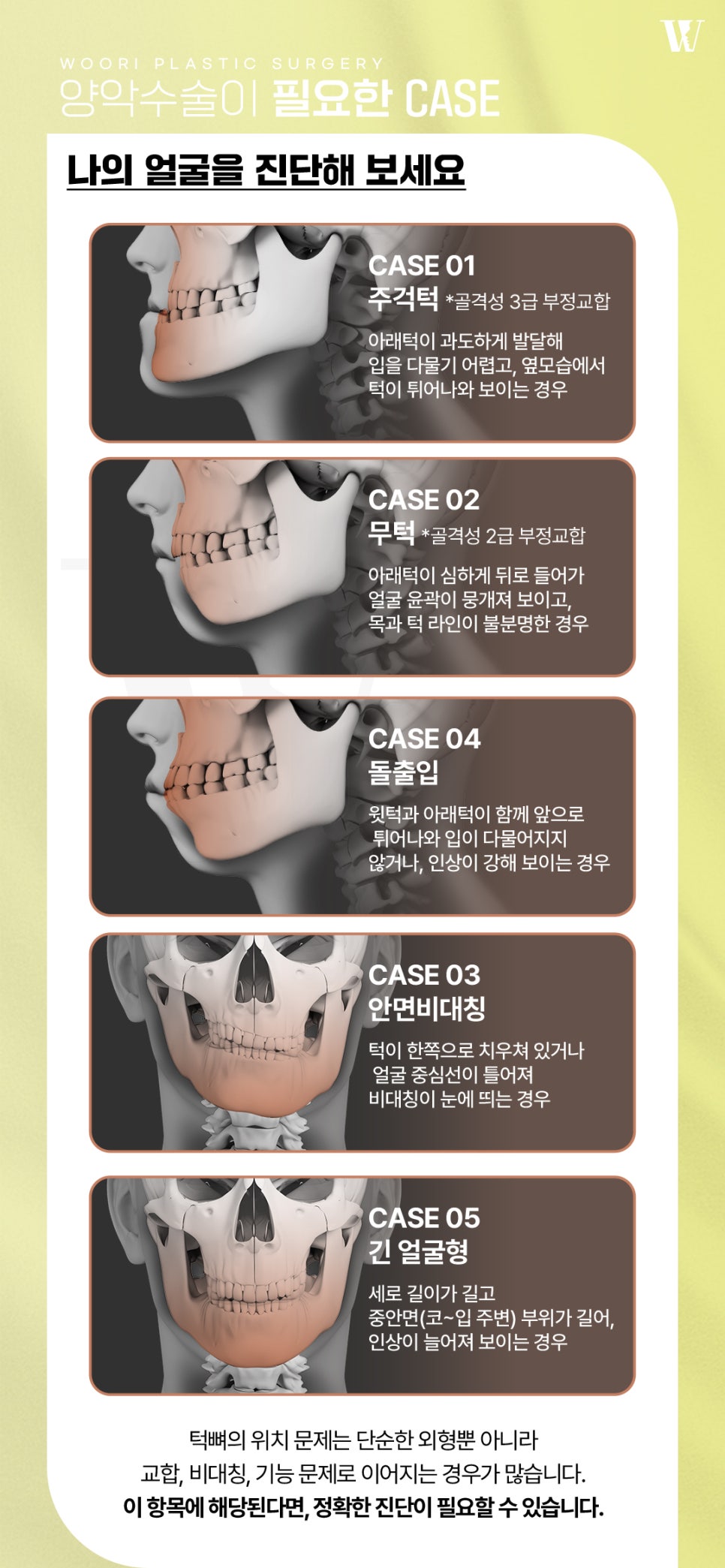 얼굴비대칭 양악수술로 개선 가능한 경우는? 관련 이미지 4