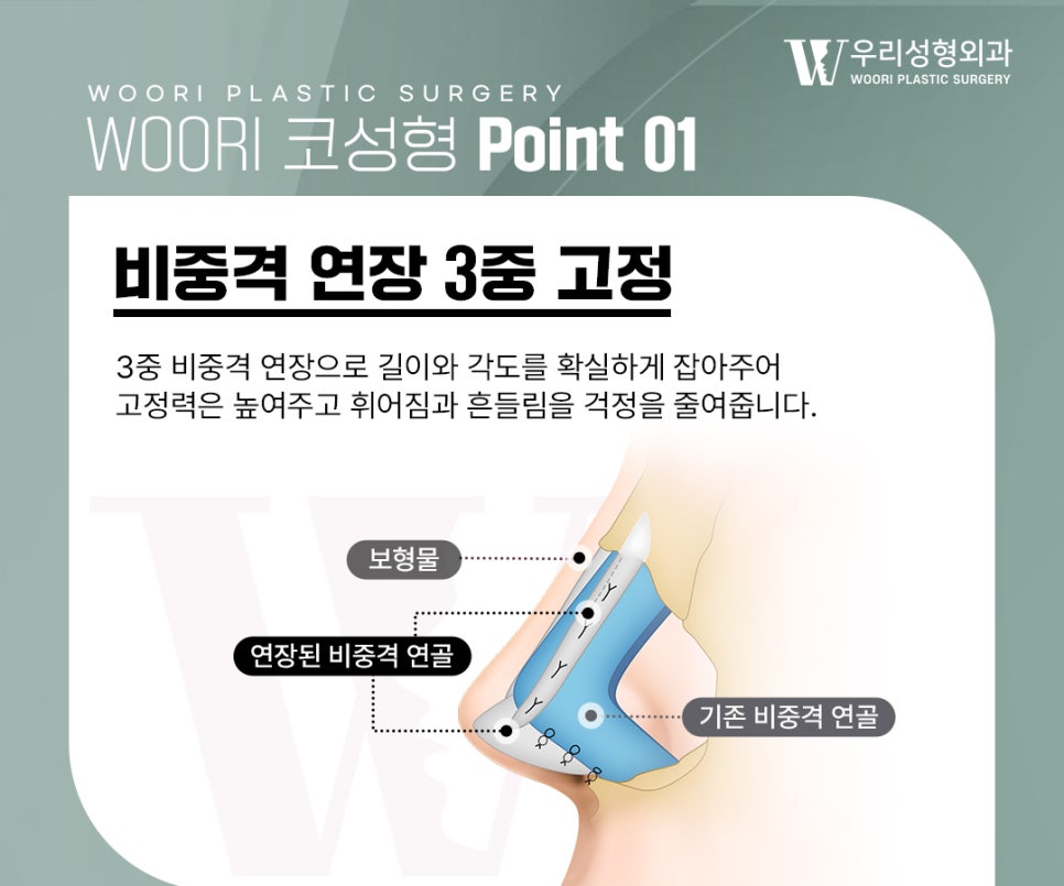 코수술비용 코끝을 안정적으로 디자인하는 과정 관련 이미지 2