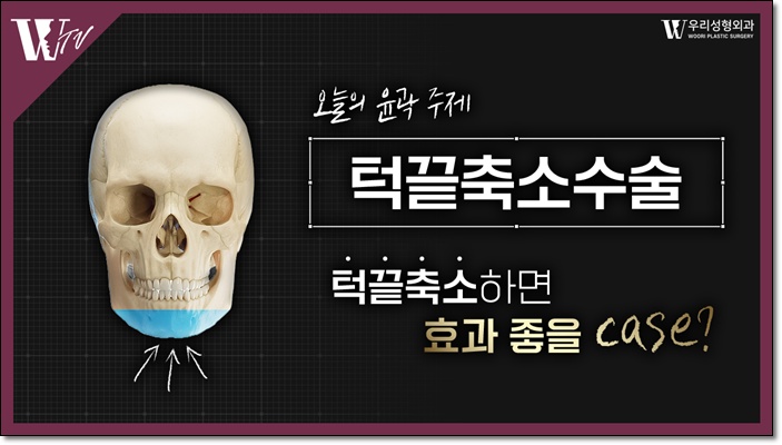 턱끝축소술 조화롭게 디자인 하려면 관련 이미지 1