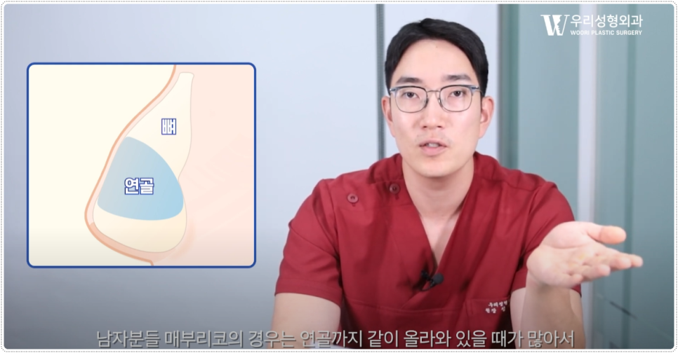 남자 코 성형 잘하는곳 기준 알아보기 관련 이미지 2
