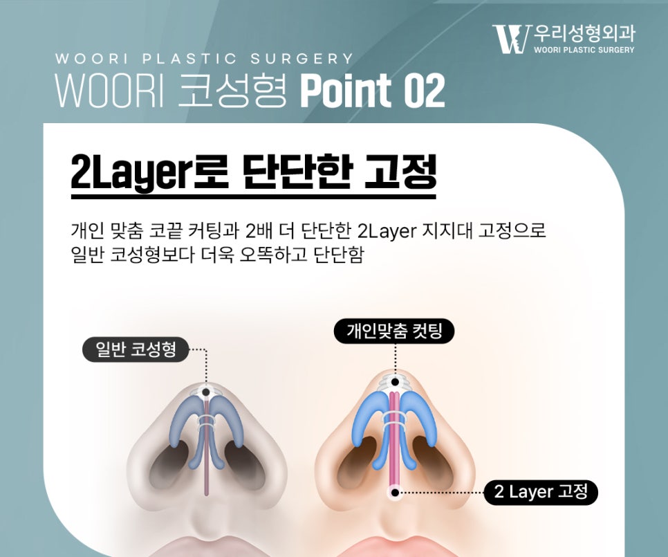 남자코성형 자연스러운 직선코 만드는 방법 관련 이미지 3