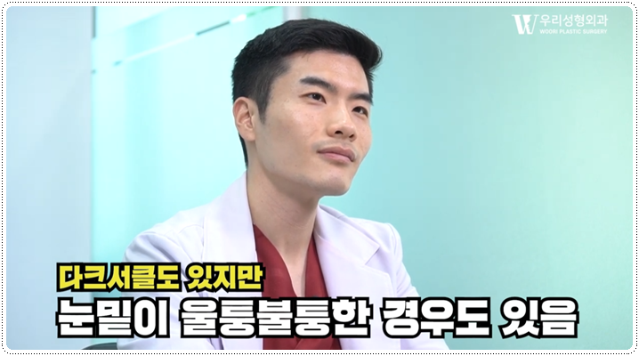 눈밑지방재배치 필요한 이유 알아보자! 관련 이미지 4