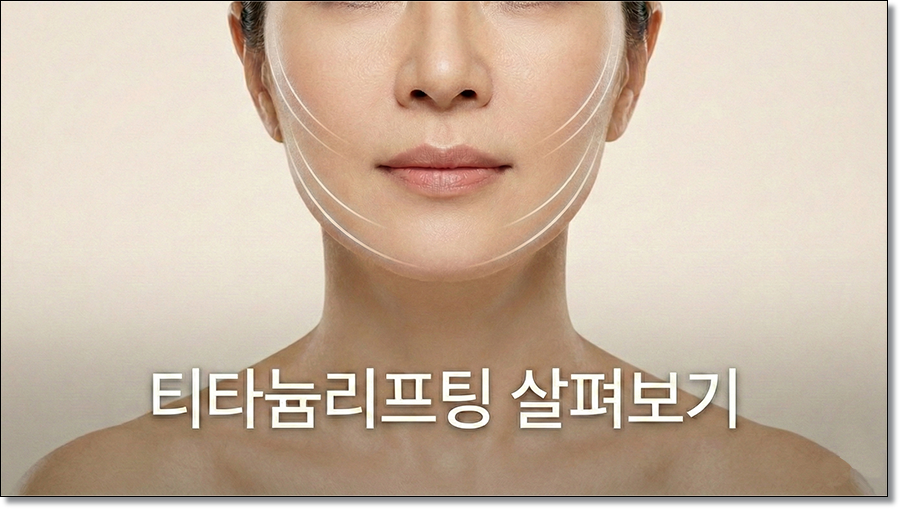 티타늄리프팅 효과와 후기 관련 이미지 1