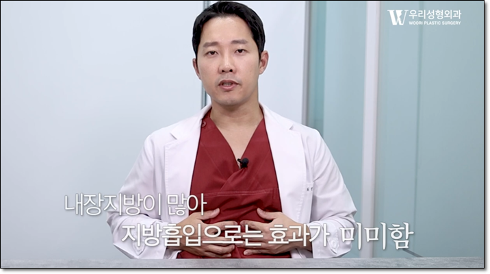 복부지방흡입 효과가 있으려면 관련 이미지 3