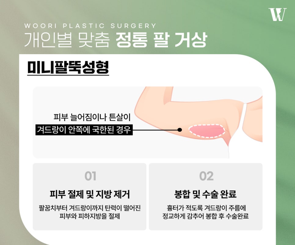 팔거상 늘어진 팔뚝살에 필요한 이유 관련 이미지 4