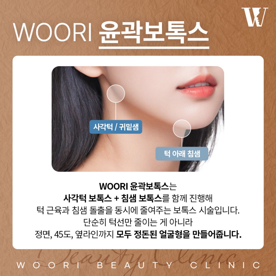 사각턱보톡스 효과 얼마나 달라질 수 있을까? 관련 이미지 2