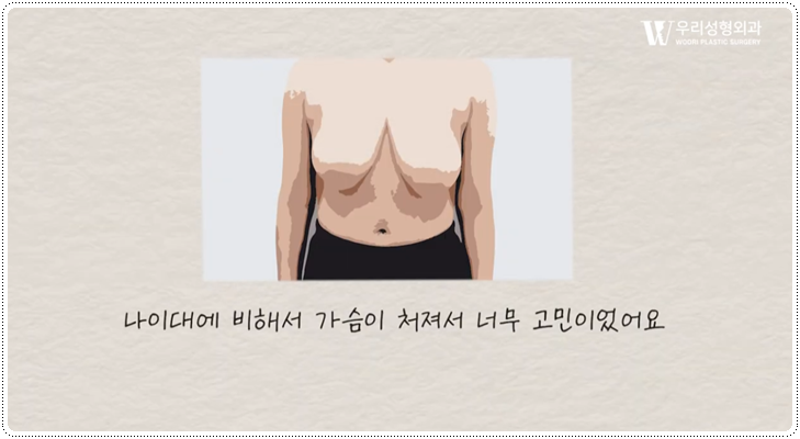 가슴축소 후기 후회 없으려면 관련 이미지 2
