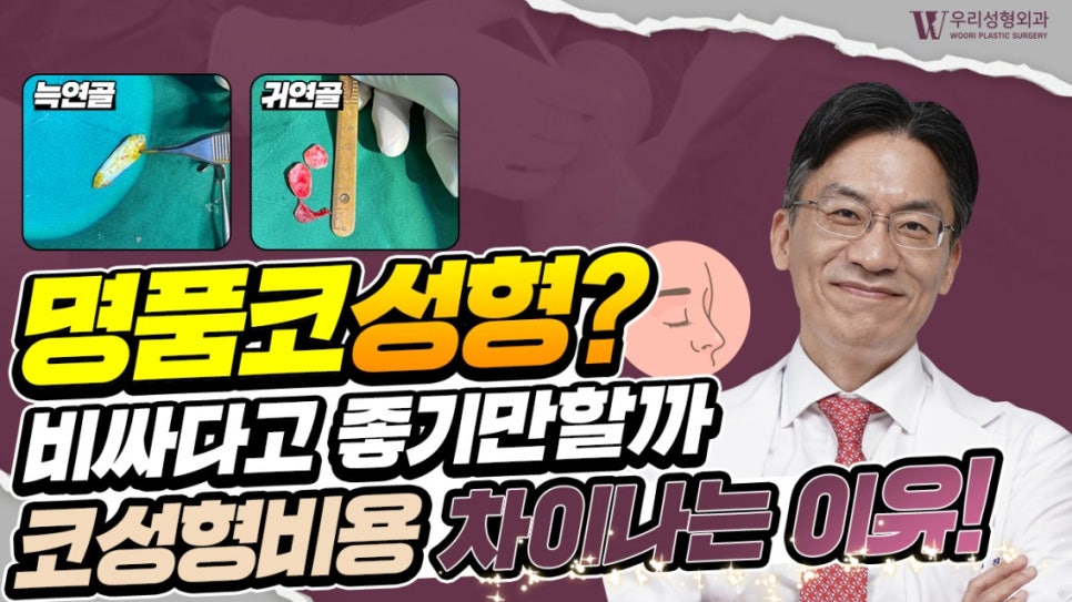 우리성형외과 임평진 원장 명품코 성형?비싸다고 좋기만할까? 코성형비용 차이나는 이유! 관련 이미지 1
