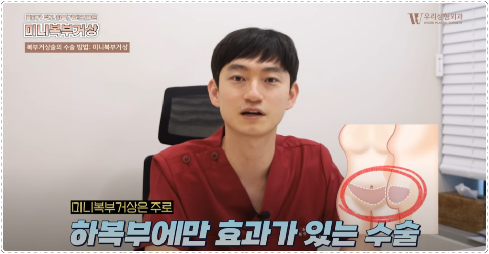 복부거상술 상담 전 체크 사항 관련 이미지 5