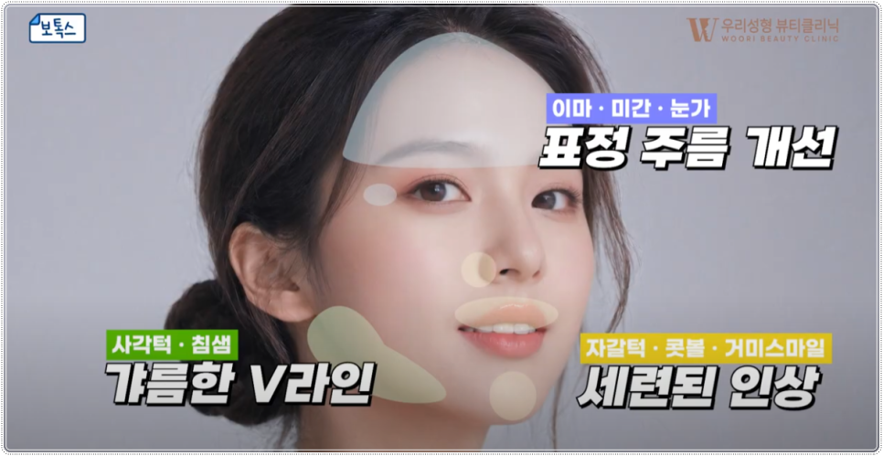 스킨부스터 종류 총 정리! 관련 이미지 4