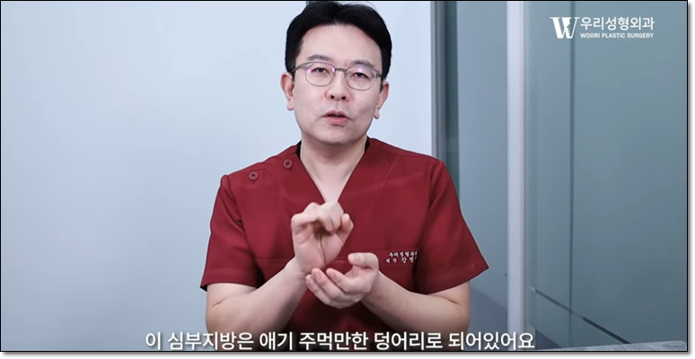 심부볼 제거 안면거상이 필요한 이유 관련 이미지 3