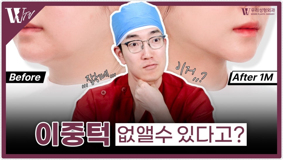 이중턱살 시술 근육묶기는 해야할까요? 관련 이미지 1