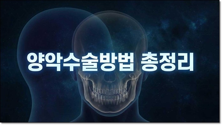 양악수술잘하는곳 찾으려면! 관련 이미지 1