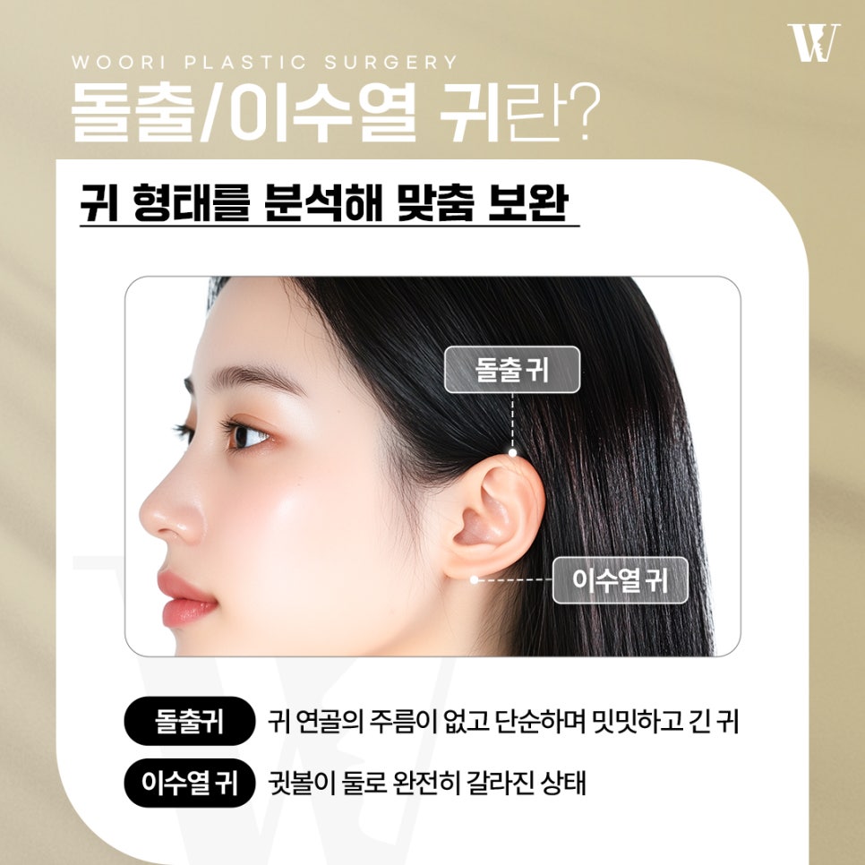 귀성형이 필요한 경우와 이상적인 귀 비율 알아보기 관련 이미지 2