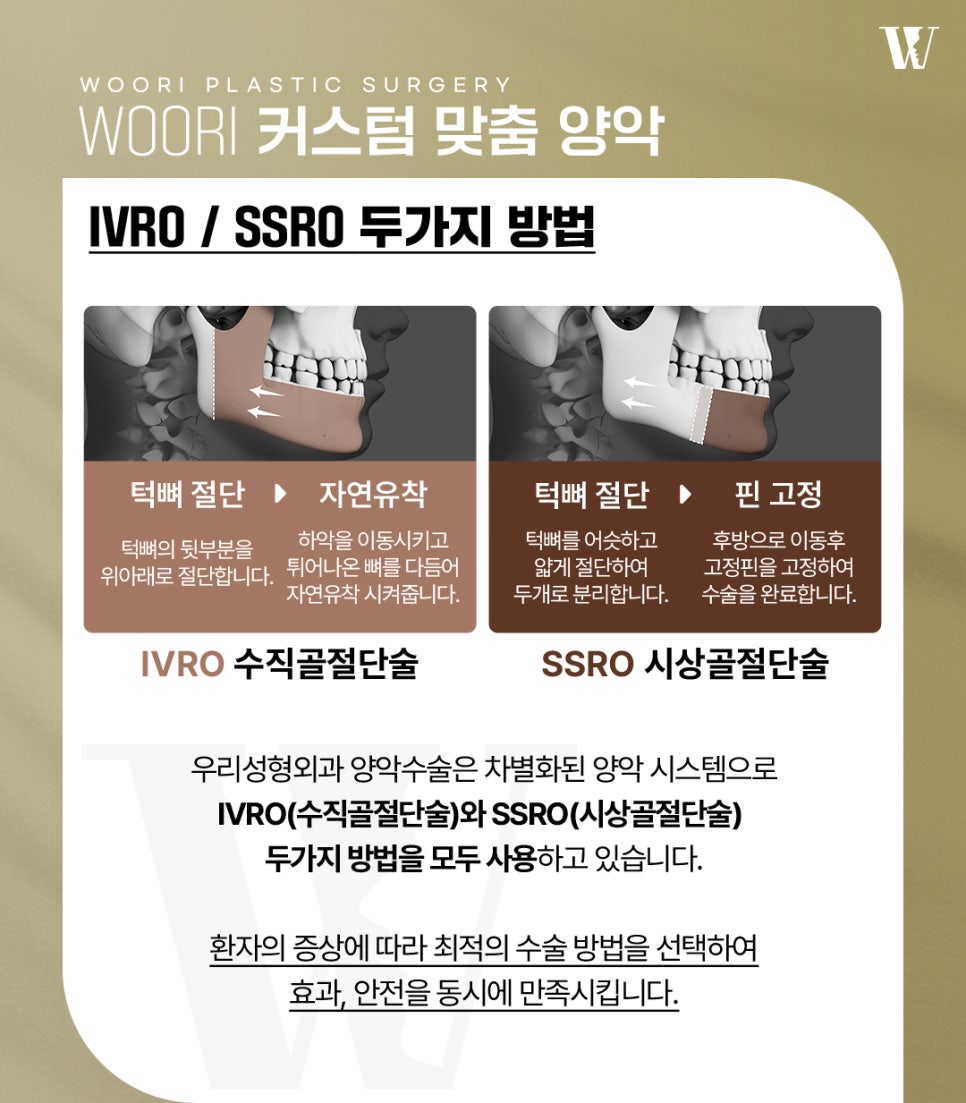 양악후기 주걱턱과 긴 얼굴은 수술 후 어떻게 달라질까요? 관련 이미지 4