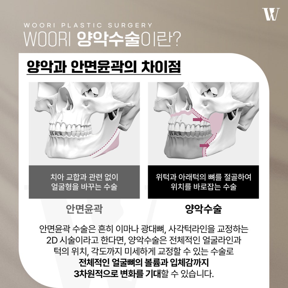양악수술 얼굴 균형과 기능을 함께 고려하는 이유 관련 이미지 2