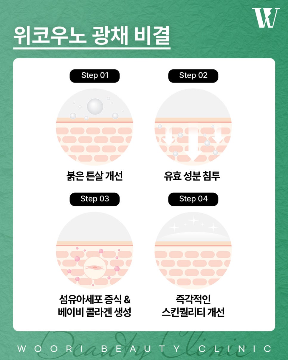 위코우노 피부 속 수분 저장고가 중요한 이유 관련 이미지 4