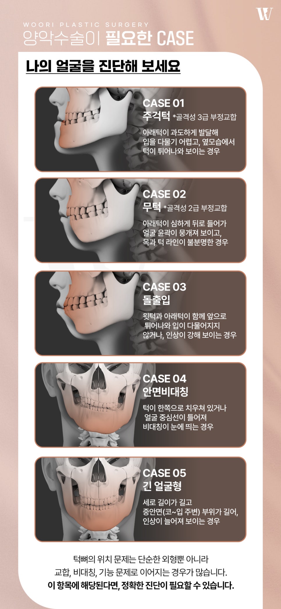 양악수술 얼굴의 균형을 되찾는 방법 관련 이미지 2
