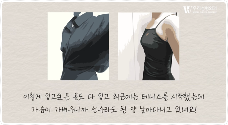 가슴축소 후기 후회 없으려면 관련 이미지 6
