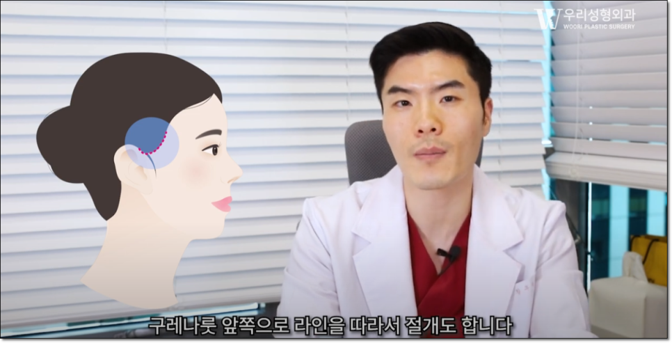 미니거상 효과 좋을까? 관련 이미지 4