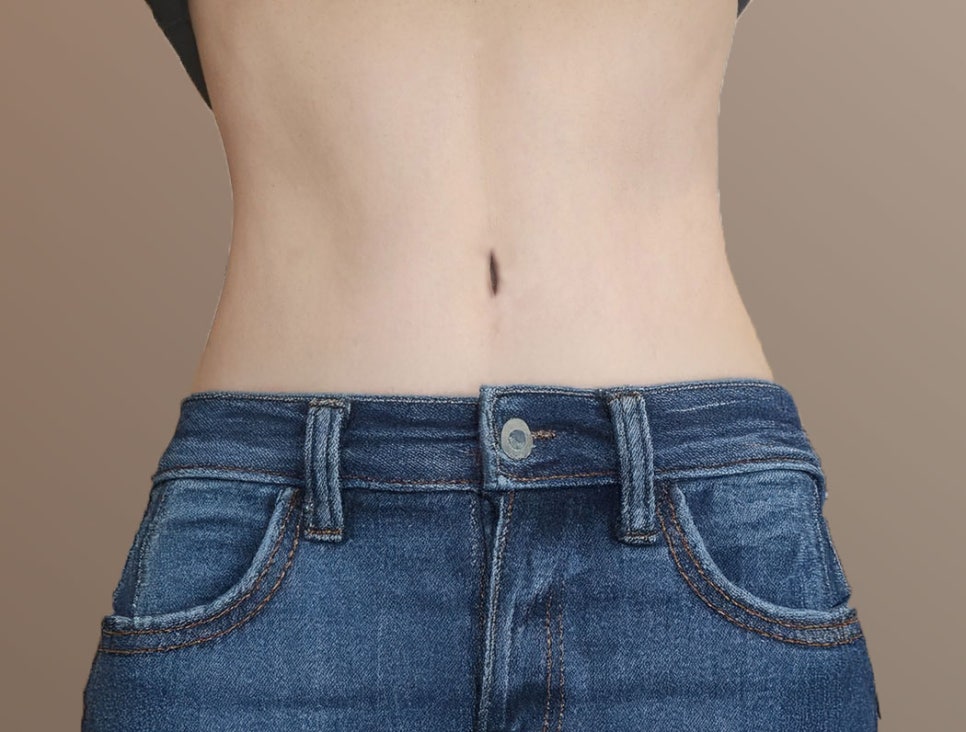 복부지방흡입 비용 확인해볼까 관련 이미지 7
