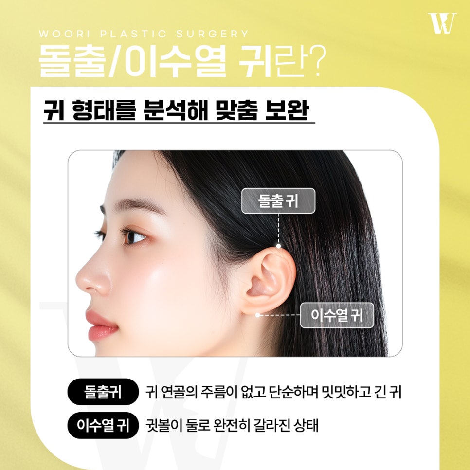 If You’ve Been Having Trouble Tying Your Hair Because of Protruding Ears! image 2