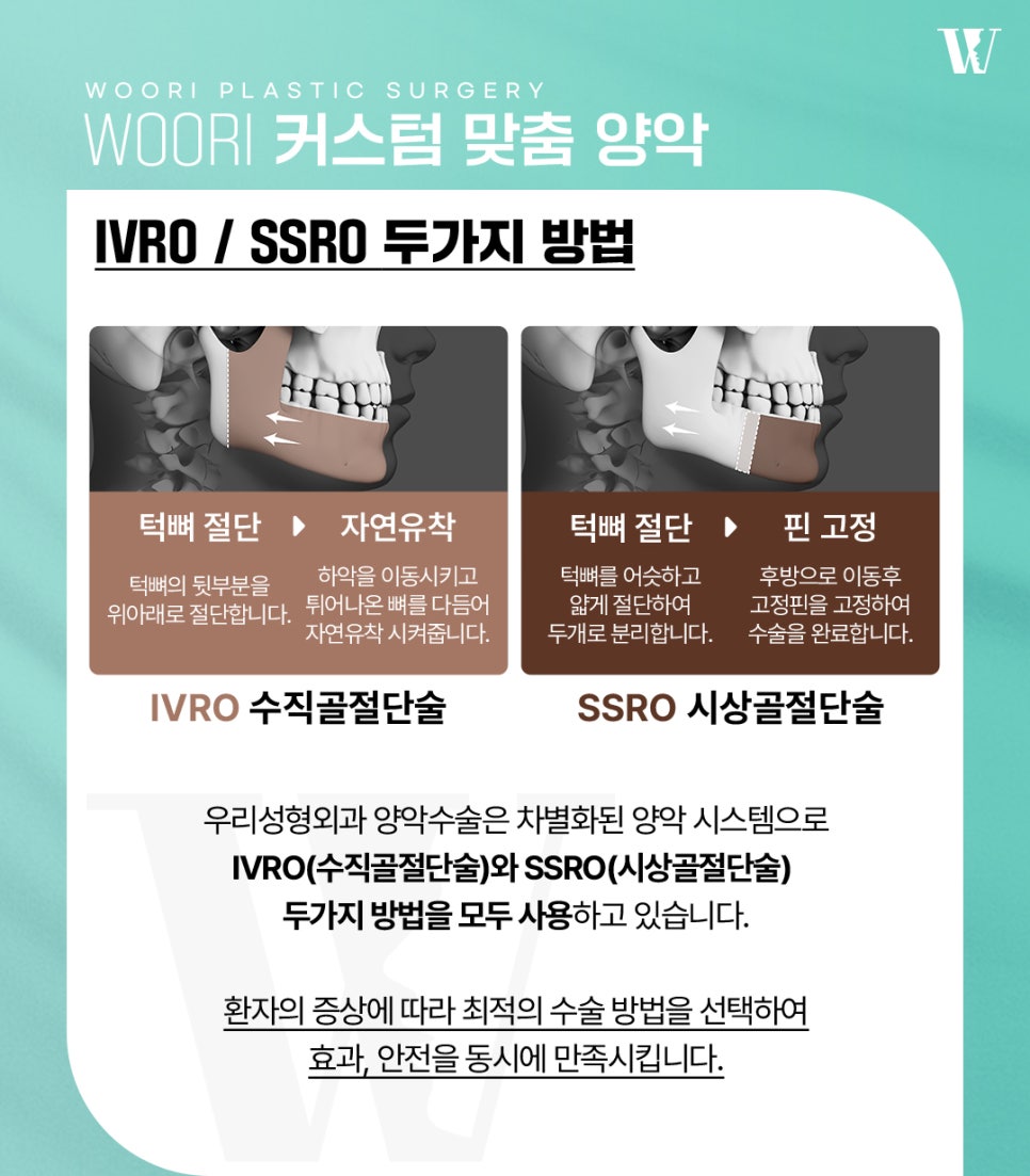 양악수술 안면윤곽과 무엇이 다를까? 관련 이미지 4