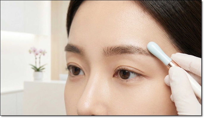 타투제거후기 피코레이저로 해야하는 이유 관련 이미지 5