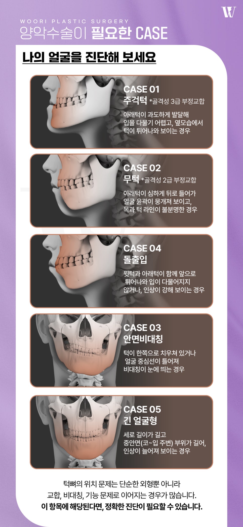 주걱턱교정 양악수술이 필요한 이유 관련 이미지 3