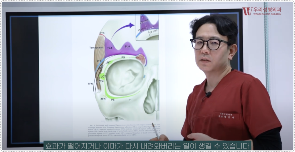 내시경이마거상술 비용 알아보기 전 관련 이미지 5