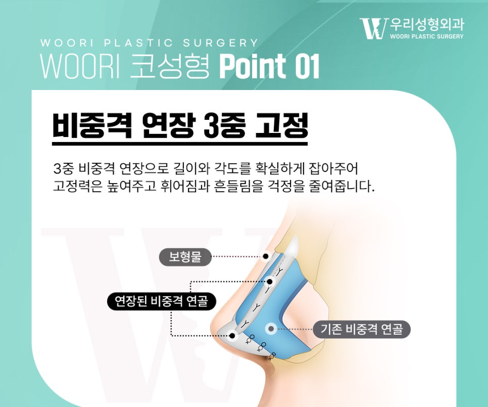 비중격코수술 코끝이 쉽게 처지지 않으려면? 관련 이미지 3