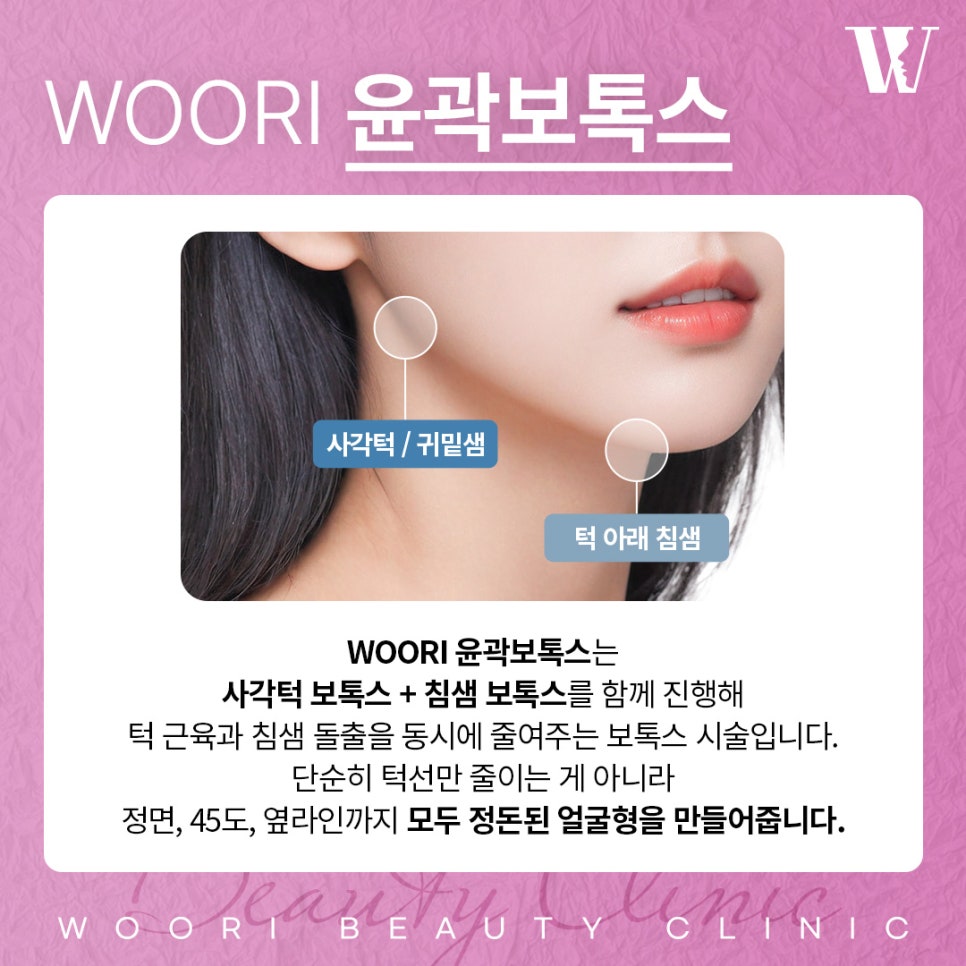 턱보톡스효과 갸름해 보이는 변화는 언제부터? 관련 이미지 2