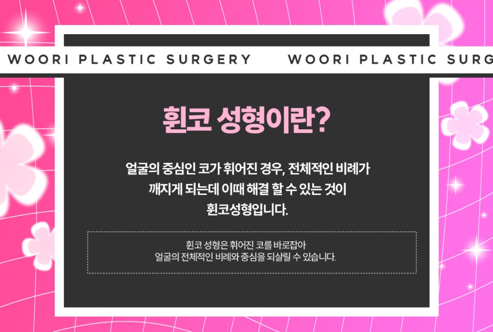 휜 코성형 방법과 코 수술 비용, 가격 궁금하다면 관련 이미지 3