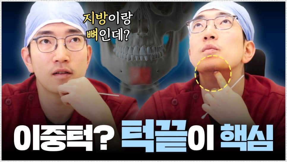 이중턱살제거 턱끝수술도 함께 해야해 관련 이미지 1