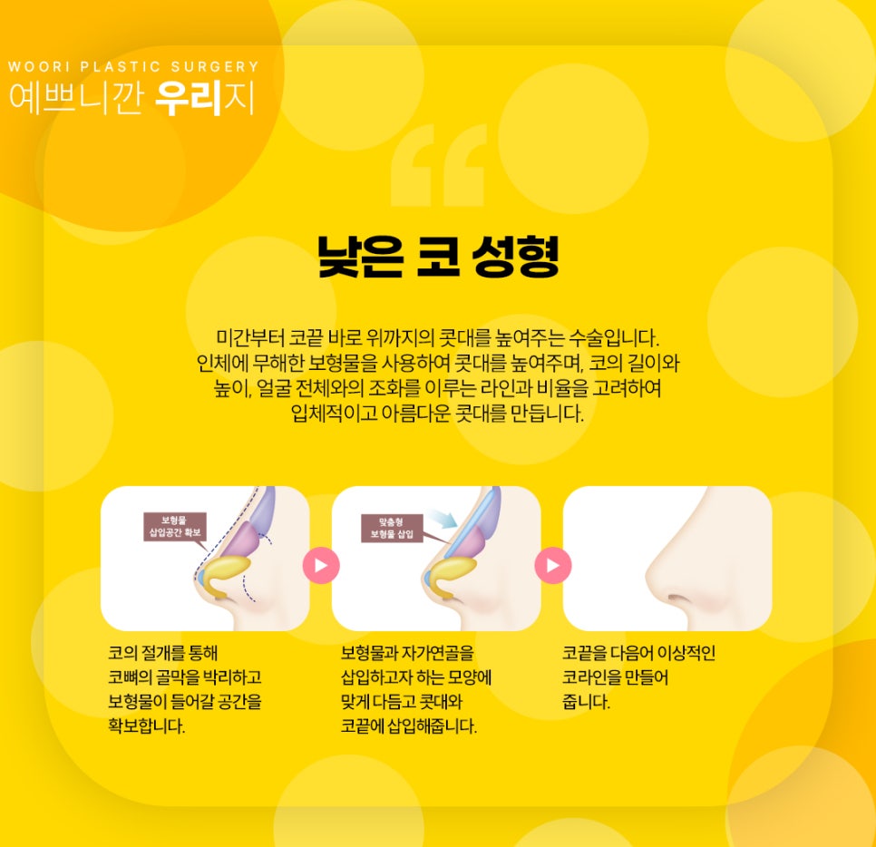 코성형 후 붓기 , 부작용 , 염증 치료를 위한 코성형 후기 관련 이미지 5