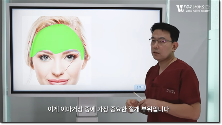 내시경이마거상 수술 방법 알아보자 관련 이미지 3
