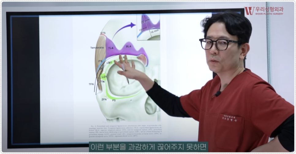내시경이마거상술 비용 알아보기 전 관련 이미지 4
